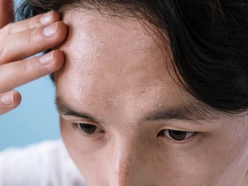 5 Fungsi Kelenjar Keringat pada Tubuh? Kenali Yuk!