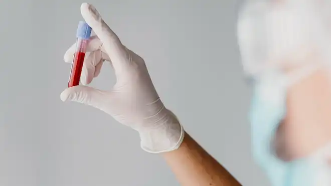 5 Persiapan Sebelum Donor Darah, Wajib Diperhatikan!