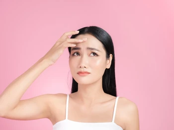 6 Penyebab Jerawat di Jidat dan Cara Ampuh Mengatasinya