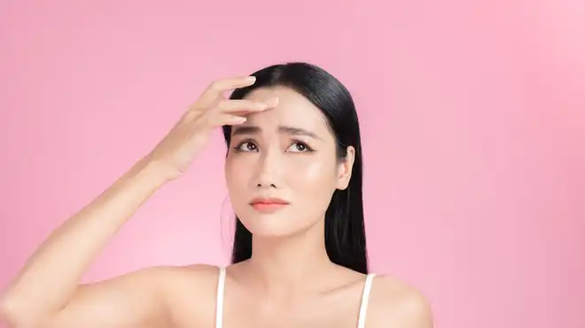 6 Penyebab Jerawat di Jidat dan Cara Ampuh Mengatasinya