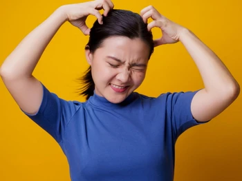 5 Cara Mengatasi Kulit Kepala Kering & Mengelupas, Coba Yuk